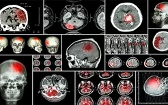 儿童癫痫患者的药物治疗有什么危害吗？