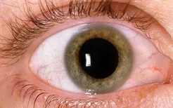 如何消除红血丝更有效？眼睛里有红血丝的原因是什么？