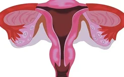 子宫颈癌的诊断需要什么样的检查？一看就知道了！