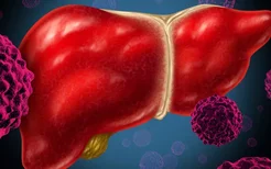 谷丙转氨酶慎重对待3个条件诊断肝炎