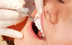 你知道如何选择补牙材料吗？补牙的重要性你知道吗