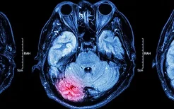 癫痫病患者可以吃口香糖吗？癫痫病应该怎么去预防？