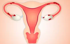 早期宫颈癌的发生往往没有征兆，女性如何预防宫颈癌