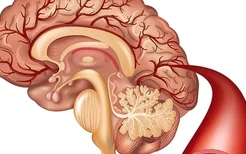 癫痫病的预防方法和典型症状