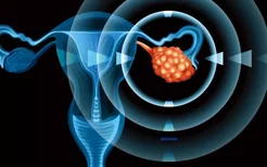 宫颈癌有4个前兆需警惕,6种方法有效预防宫颈癌