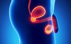 前列腺增生是什么原因引起的,房事过度会导致前列腺增生吗
