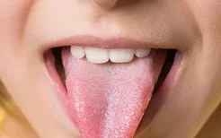 舌苔厚黄是怎么回事？吃什么食物可以缓解舌苔厚