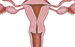 女性远离宫颈癌需要戒烟，推荐宫颈癌的食疗方