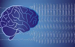 癫痫治疗常见3种方法,患者需因情况而异