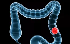 反酸胃痛是胃炎引起的吗？