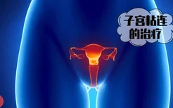 人工流产会增加宫颈癌的患病风险吗？5类女性需要警惕宫颈癌变化