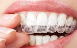 牙疼怎么办立刻止痛,6个简单方法可以快速止牙痛