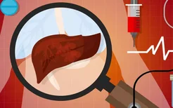 腋臭可能是乙型肝炎的信号吗？你知道乙型肝炎的四个症状吗？