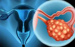 防子宫肌瘤的饮食需要注意什么？子宫肌瘤多见于哪些女性？