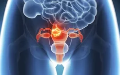 阴道出血和压迫症状要警惕宫颈癌,5种女性容易患宫颈癌