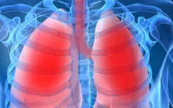 肺栓塞的症状是什么？肺栓塞的发病原因有哪些？