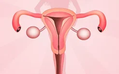 久坐会导致子宫内膜异位,子宫内膜异位容易被误诊