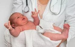 什么是新生儿黄疸,宝宝黄疸是什么意思