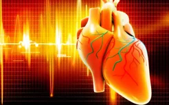 能查出心肌梗塞的心电图吗？