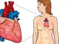 ct冠状动脉造影怎么办？
