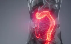 非萎缩性胃炎是什么病？